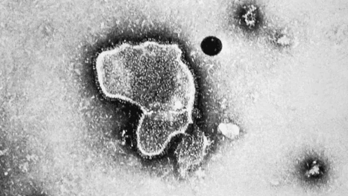 HMPV: saiba se vírus que se espalha na China pode se tornar uma pandemia