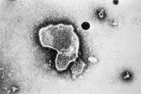 HMPV: saiba se vírus que se espalha na China pode se tornar uma pandemia