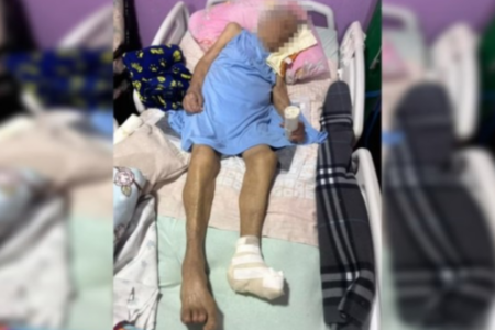 Idosa que teve o pé amputado no DF (Foto: Reprodução)