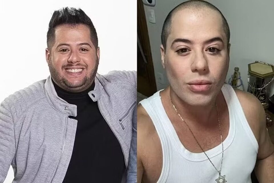 Cantor ficou famoso ao participar do reality "Fama", em 2004 Sertanejo Hugo, da dupla com Tiago, após harmonização e lipo