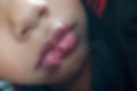 Cachorro ataca e arranca pedaço da boca de menino de 4 anos em Águas Lindas