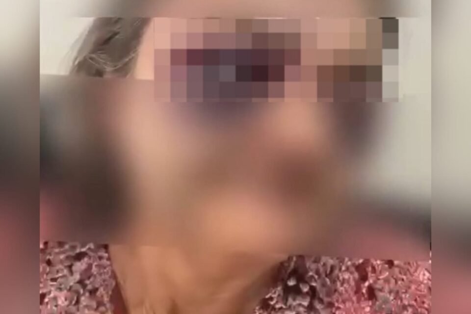 A imagem mostra a foto de um idosa com o rosto disfigurado pelas agressões