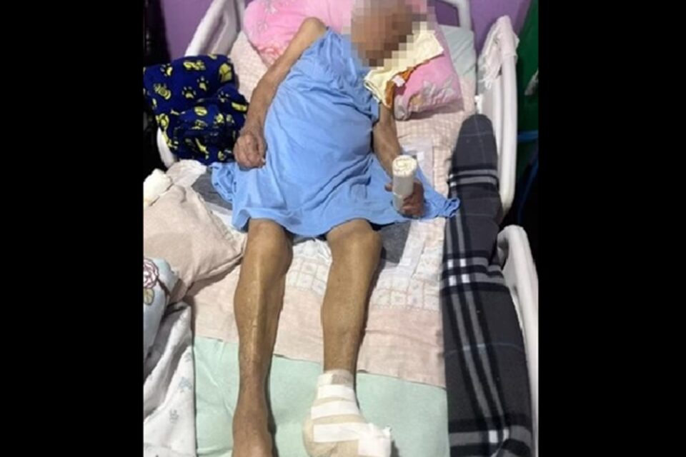 Idosa de 103 anos tem pé amputado sem anestesia e com bisturi cego no DF Cirurgia clandestina foi realizada num apartamento, na Asa Norte