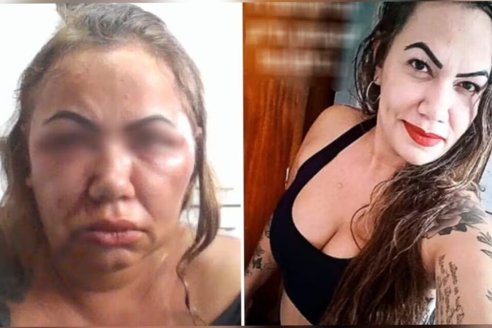 Professora Livia Alves Branquinho denúncia agressão de ex-companheiro, em Goiânia