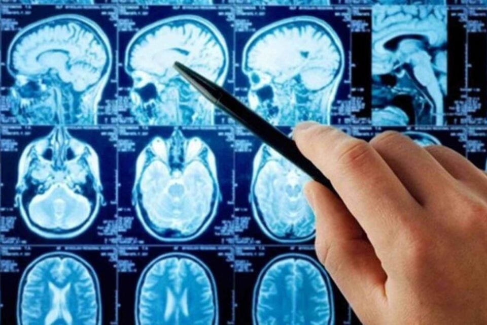 Secretaria de Saúde de Goiás deve providenciar cirurgia em paciente com tumor cerebral