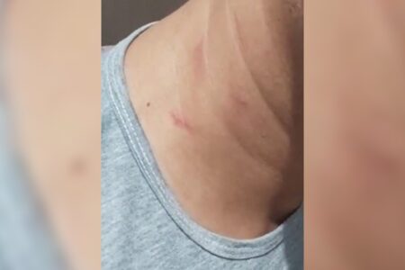 Conselheiro tutelar de Goianira denuncia agressão de prefeito