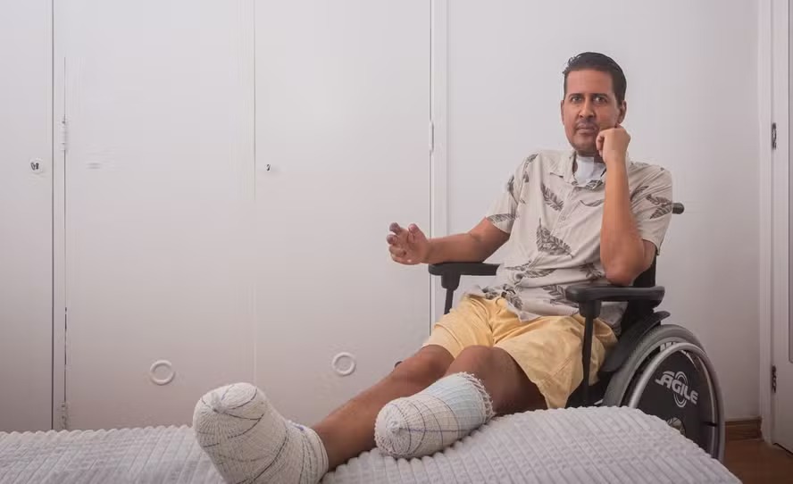 Jornalista fica em coma e tem membros amputados após cirurgia de apneia do sono Julio Cesar Trindade acredita que houve negligência médica