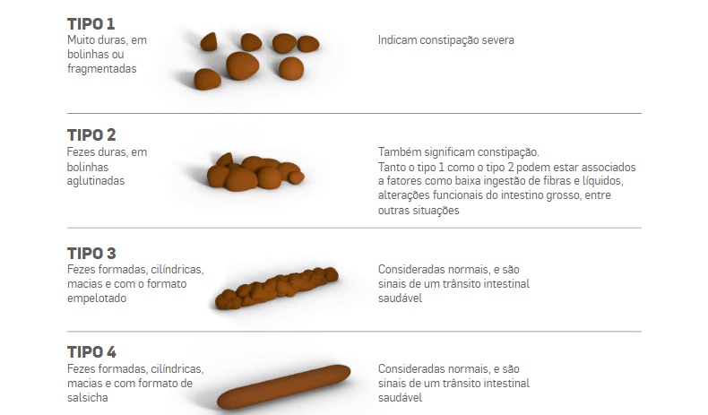 FONTES: SU BONG KIM, CIRURGIÃO DO APARELHO DIGESTIVO DO HOSPITAL ALEMÃO OSWALDO CRUZ (SP), E VICTOR SEID, MEMBRO TITULAR DA SOCIEDADE BRASILEIRA DE COLOPROTCOLOGIA (SBCP) (Infográfico: Estadão)
