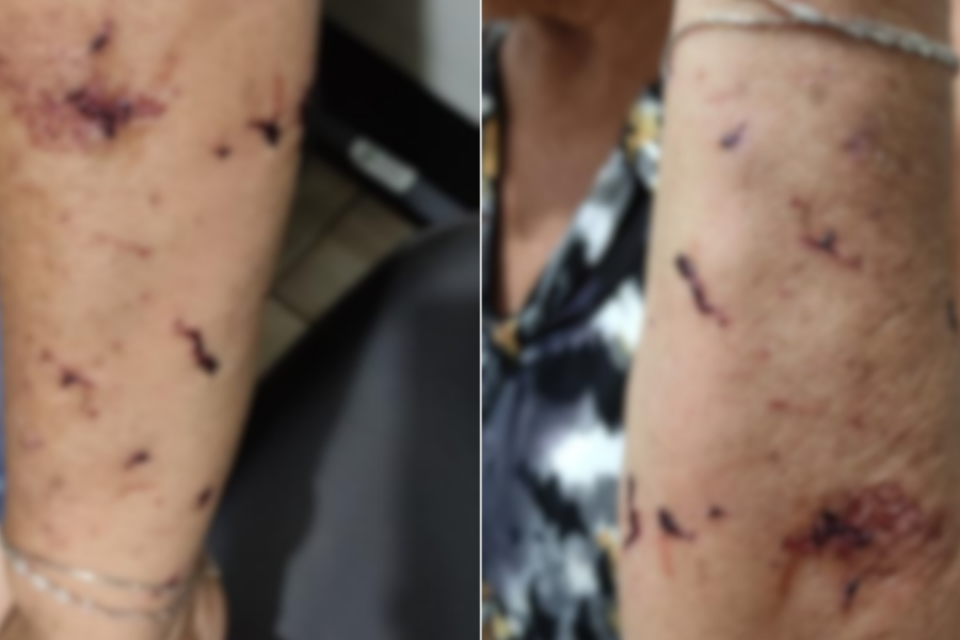 Jovem é preso suspeito de agredir a avó com um copo de vidro quebrado em Rio Verde