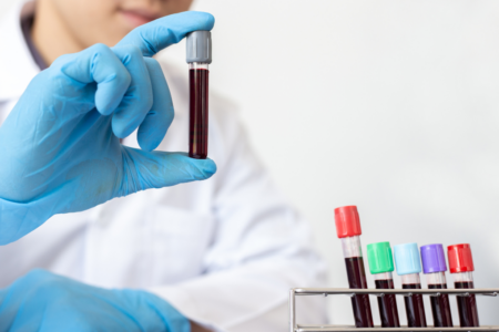 Imagem de amostras de sangue