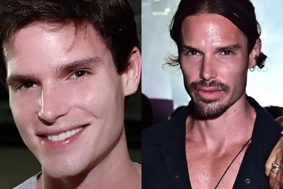 Jonatas Faro rebate críticas sobre sua harmonização facial beleza Ator iniciou a carreira em "Malhação" e hoje é corretor de imóveis