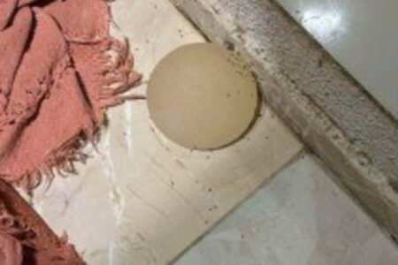 Silicone arrancado pelo criminoso com uma faca no DF (Foto: Reprodução)