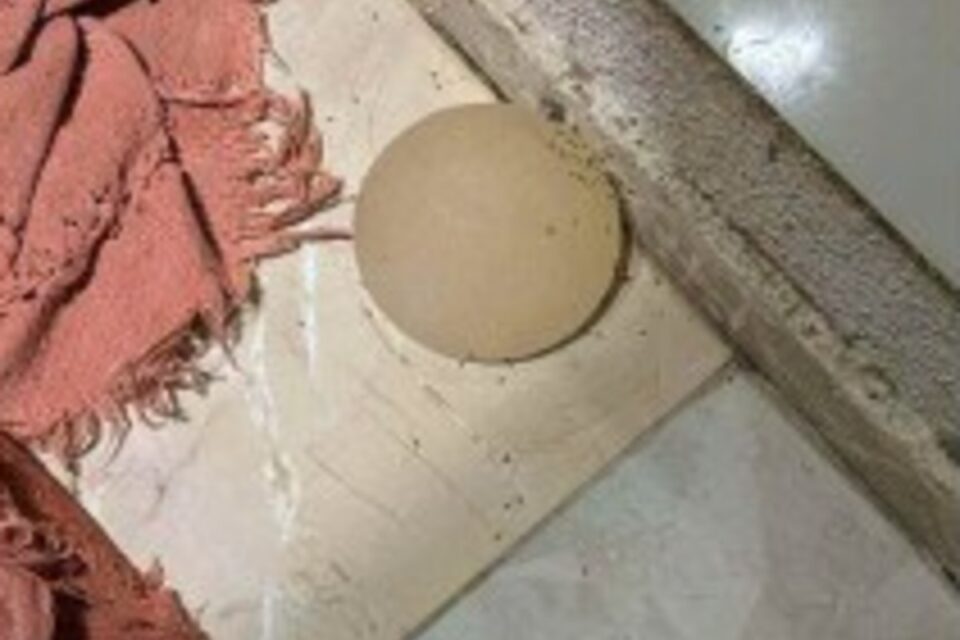 Silicone arrancado pelo criminoso com uma faca no DF (Foto: Reprodução)