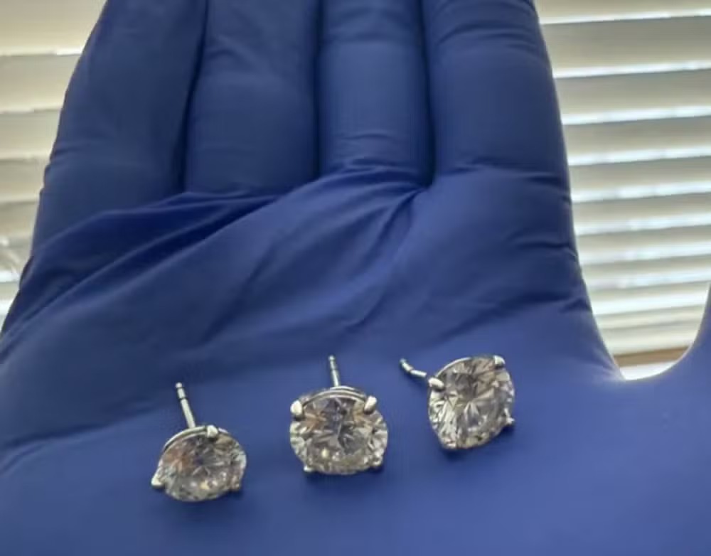 Polícia dos EUA recupera joias de R$ 4 milhões engolidas por ladrão raio-x divulgado pelas autoridades mostraram objetos no estômago