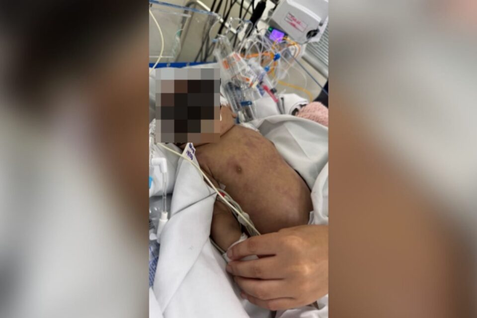 A imagem mostra a neném internada com baixa saturação