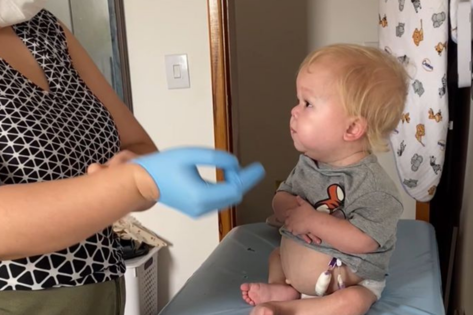 Campanha busca ajuda para cobrir tratamento de bebê com doença rara que afeta o intestino