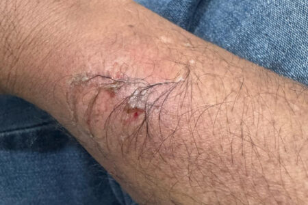 Criança morde conselheiro tutelar ao ser retirada da mãe que usava filhos para pedir dinheiro, em Goiânia