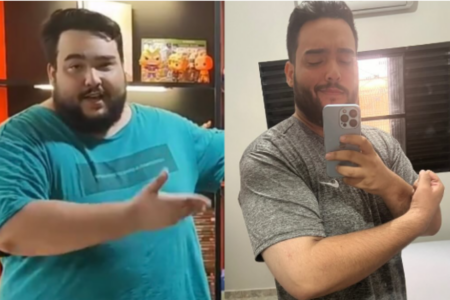 Jovem perde 109 quilos em 15 meses e relata mudanças após processo de emagrecimento