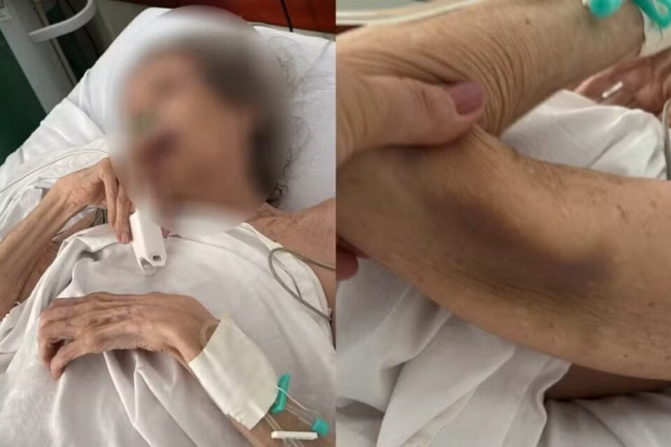 A imagem mostra a idosa internada
