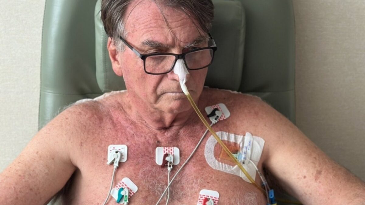 Líder do PL diz que Bolsonaro dará aval a novo texto da anistia mesmo do hospital Ex-presidente está na UTI desde nova cirurgia do abdômen