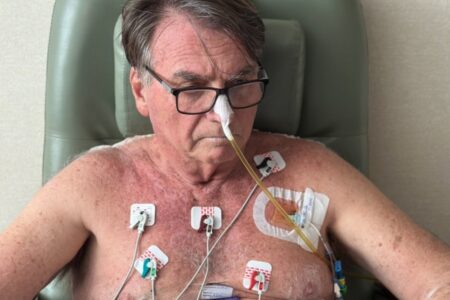 Líder do PL diz que Bolsonaro dará aval a novo texto da anistia mesmo do hospital Ex-presidente está na UTI desde nova cirurgia do abdômen