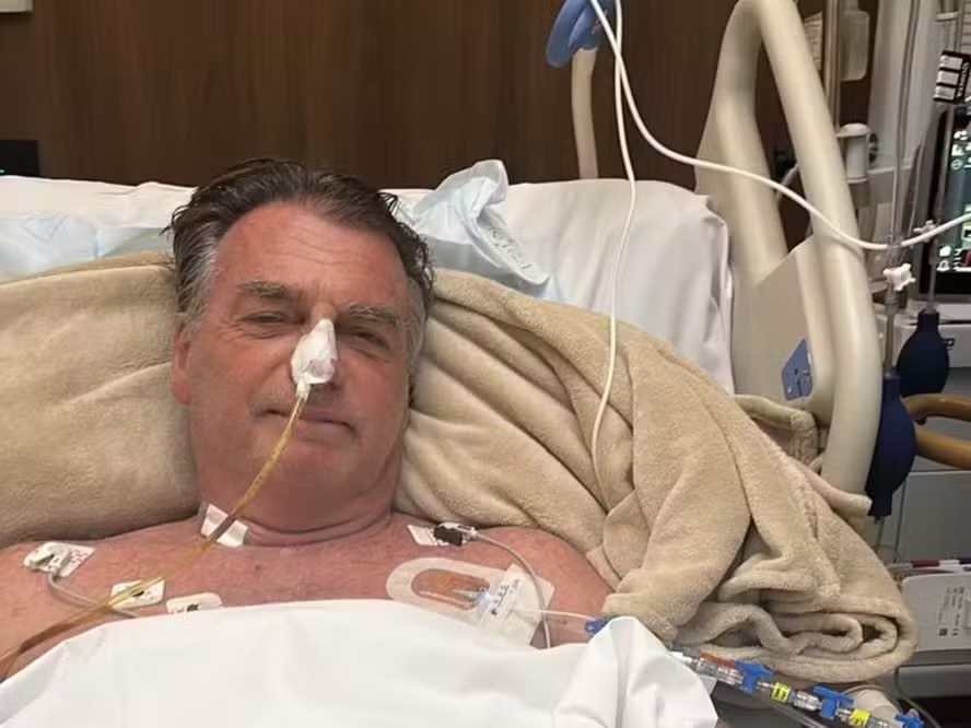 Bolsonaro segue na UTI dois dias depois da cirurgia, ainda sem previsão de alta Ex-presidente tem apresentado boa evolução clínica