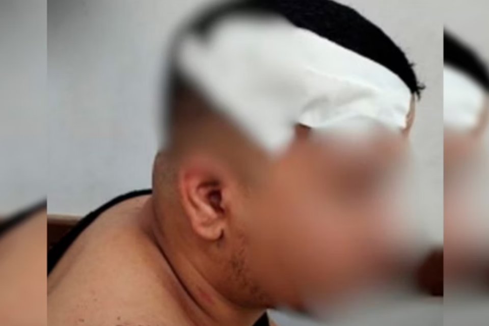 Jovem é agredido com pedaço de madeira durante partida de truco em Goiânia