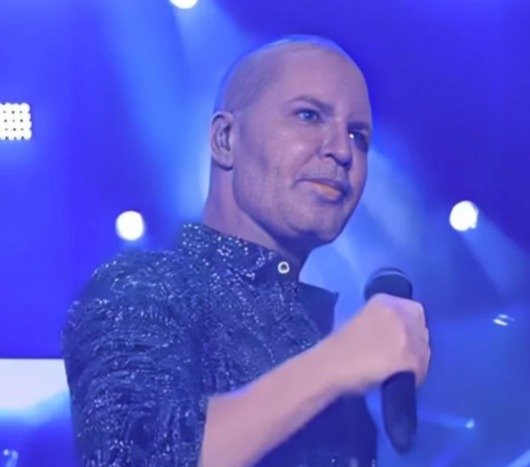 Eduardo Costa explica visual após surgir careca em show: anabolizante "Usei muita bomba no passado", disse sertanejo