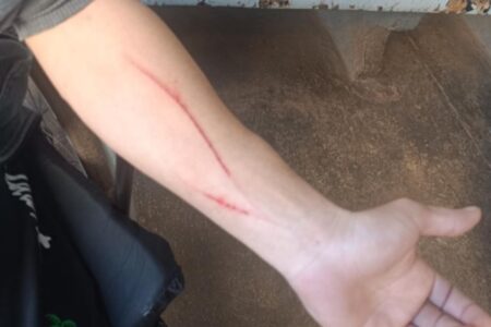 Cadeirante é preso após agredir a namorada com tesoura, em Rio Verde