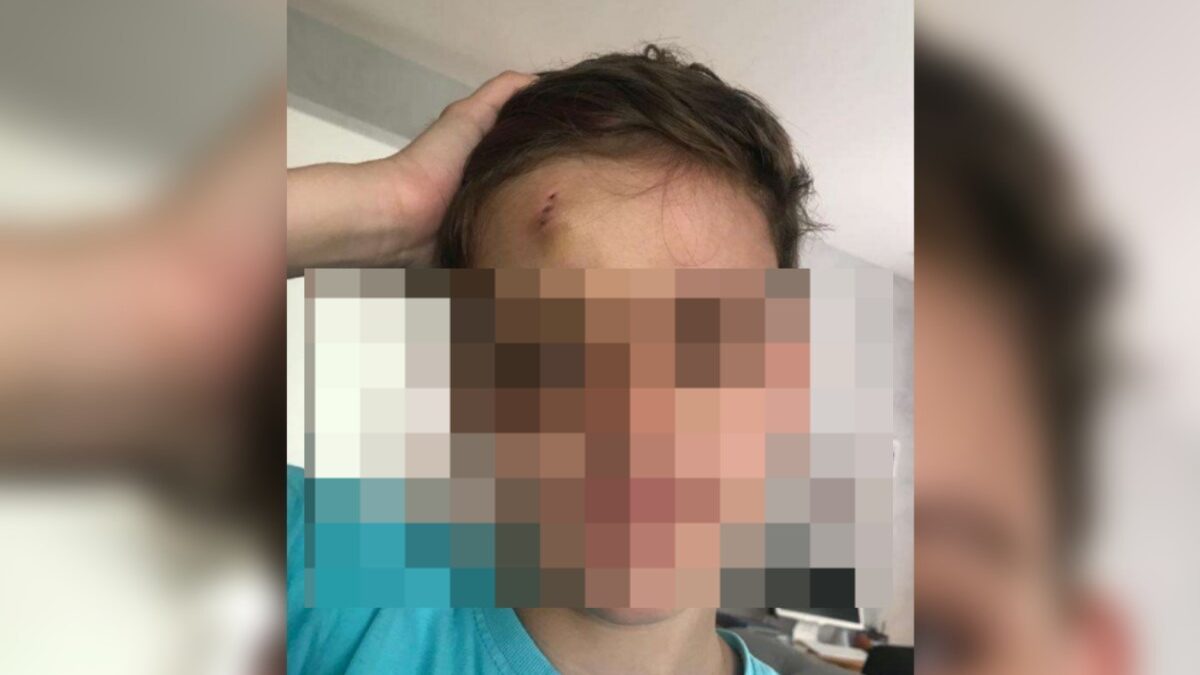 Criança de Mineiros quebra dente em navio e cruzeiro é condenado por negligência