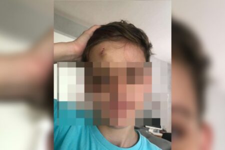 Criança de Mineiros quebra dente em navio e cruzeiro é condenado por negligência