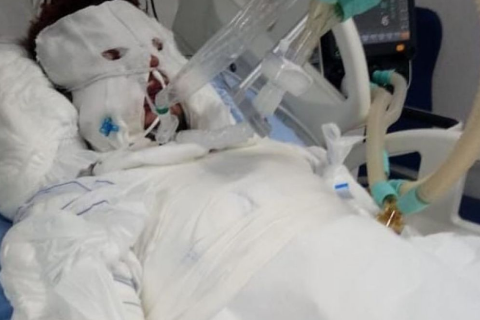 Mulher é presa suspeita de atear fogo no corpo do ex-companheiro em Rio Verde