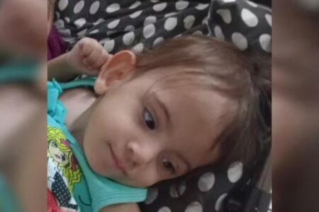 Aruna: siamesa de São Paulo separada em Goiânia passa por nova cirurgia