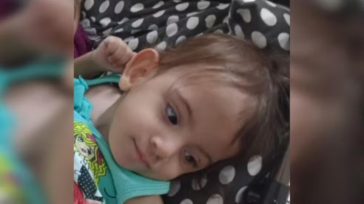 Aruna: siamesa de São Paulo separada em Goiânia passa por nova cirurgia