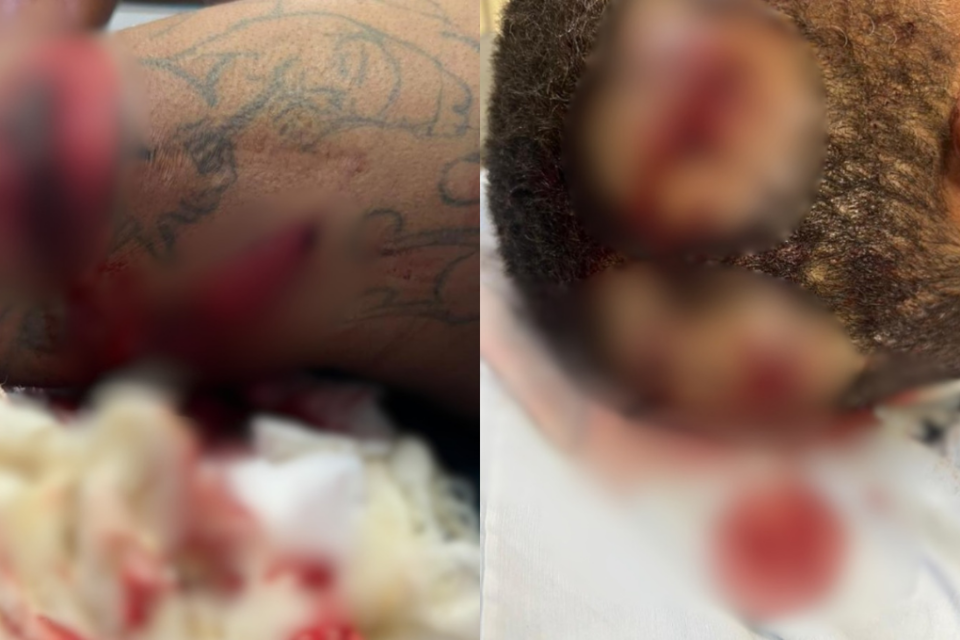 Homem é preso suspeito de tentar matar a ex-companheira com diversos golpes de faca em Luziânia