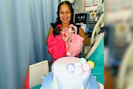 Siamesas de Manaus: gêmeas podem ser extubadas nos próximos dias
