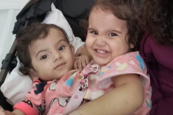 Gêmeas siamesas Kiraz e Aruna: cirurgia concluída com sucesso (Foto: Reprodução)