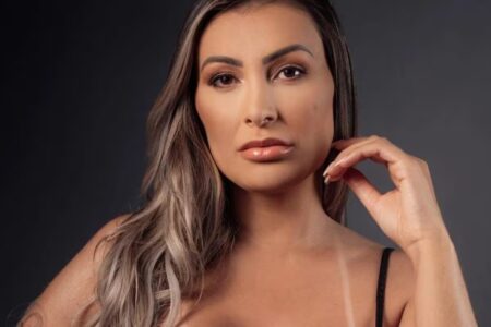 Andressa Urach faz cirurgia proibida no Brasil e mostra resultado; veja antes e depois Maya Massafera também realizou o mesmo procedimento