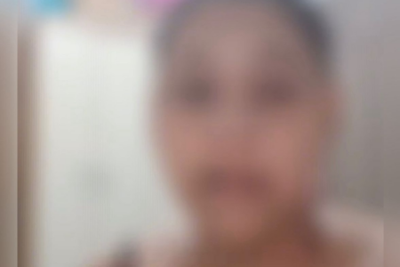 Estudante com câncer denuncia bullying (Foto: Reprodução)