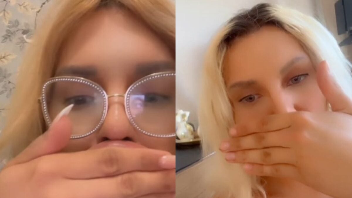 Influencer revela que não consegue respirar direito após preenchimento labial; fotos Vienna Würstel não pretende parar de turbinar os lábios