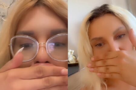 Influencer revela que não consegue respirar direito após preenchimento labial; fotos Vienna Würstel não pretende parar de turbinar os lábios