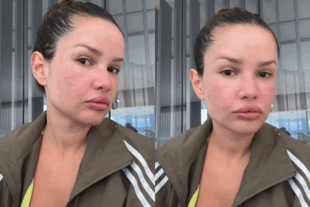 Juliette mostra resultado de procedimento estético com esperma de salmão