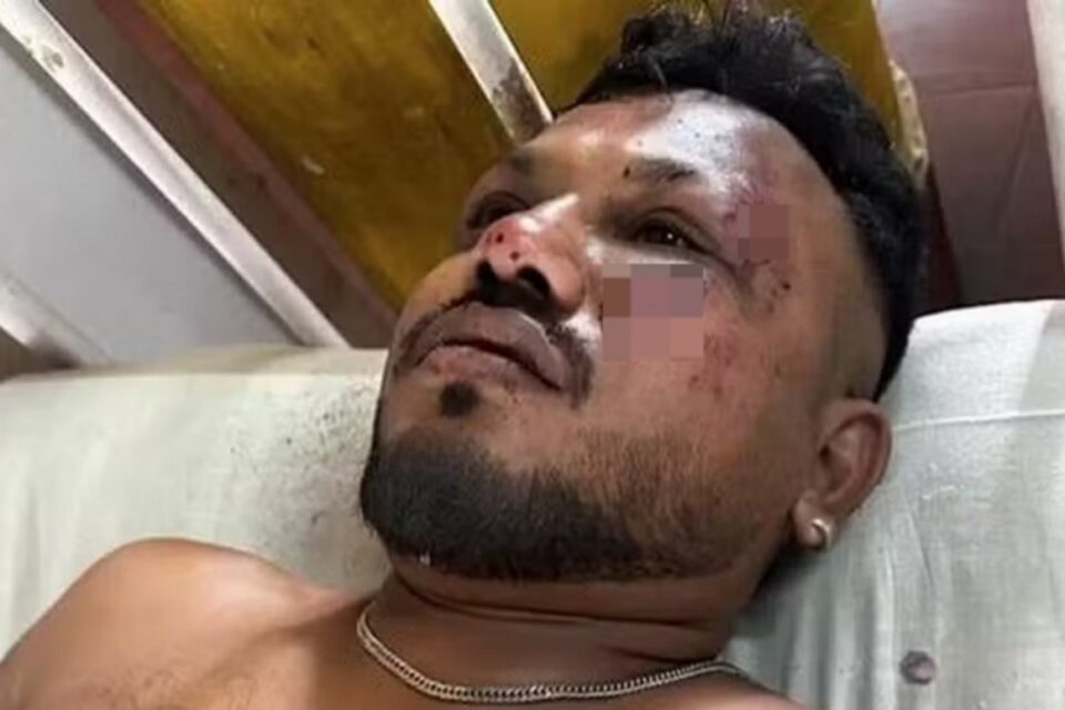 Único sobrevivente de queda de avião na Índia se sente 'culpado' e diz que vê o irmão morto Vishwash Kumar Ramesh revive o desastre