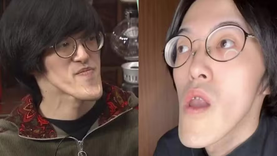 Homem Japonês com o queixo mais longo do mundo dá dicas de autoestima; fotos Jonouchi mandíbula passou a crescer de forma inesperada