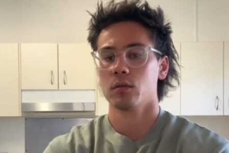 Influencer confunde cisto com espinha e fica com o rosto desfigurado; veja foto Situação levou quase nove meses para ser resolvida