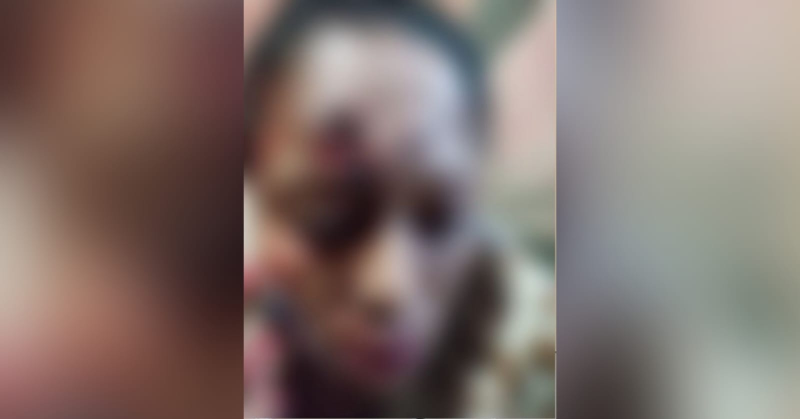 Imagem do rosto da ex-mulher deformado pelo espancamento