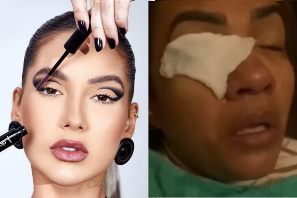 Mulher aplicou um fortalecedor de cílios Mulher diz ter ficado cega após usar produto de Virginia Fonseca; WePink se pronuncia
