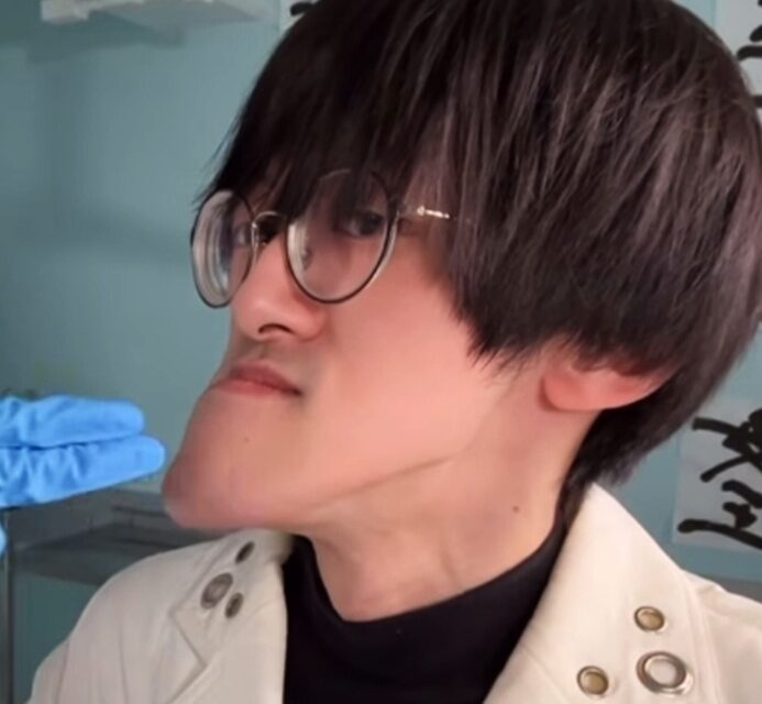 Homem Japonês com o queixo mais longo do mundo dá dicas de autoestima; fotos Jonouchi mandíbula passou a crescer de forma inesperada