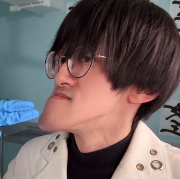 Homem Japonês com o queixo mais longo do mundo dá dicas de autoestima; fotos Jonouchi mandíbula passou a crescer de forma inesperada