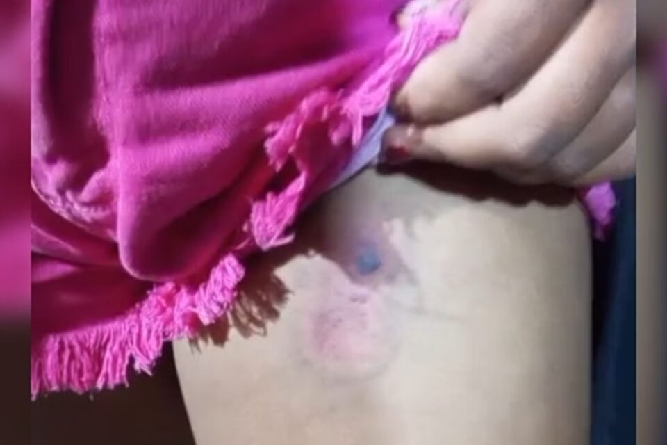 Criança é ferida com bala de borracha da PM em ação no DF